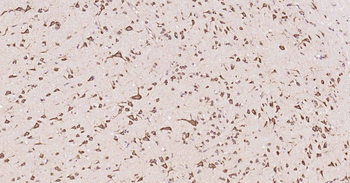 DDIT3 Rabbit Polyclonal Antibody