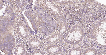 DDIT3 Rabbit Polyclonal Antibody