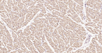 DDIT3 Rabbit Polyclonal Antibody