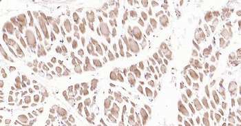 DDIT3 Rabbit Polyclonal Antibody