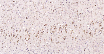 DDIT3 Rabbit Polyclonal Antibody