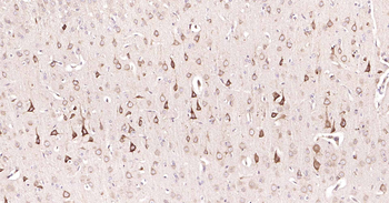 DDIT3 Rabbit Polyclonal Antibody