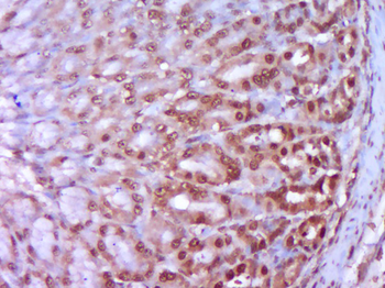 HSP27 Rabbit Polyclonal Antibody