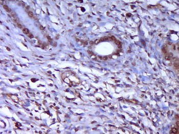 HSP27 Rabbit Polyclonal Antibody