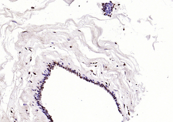 Phospho-BRCA1 (Ser1466) Rabbit Polyclonal Antibody