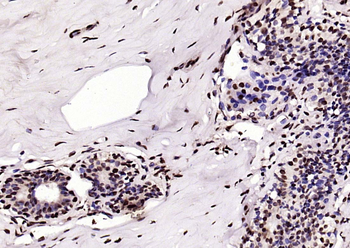 Phospho-BRCA1 (Ser1466) Rabbit Polyclonal Antibody