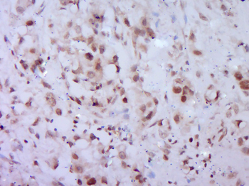 Phospho-BRCA1 (Ser1466) Rabbit Polyclonal Antibody