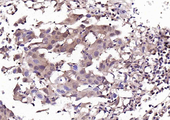 Anillin Rabbit Polyclonal Antibody