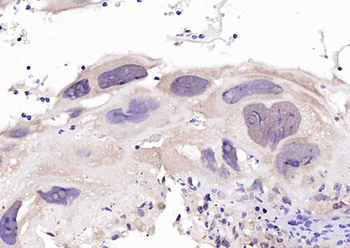 Anillin Rabbit Polyclonal Antibody