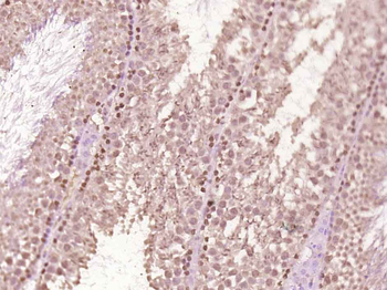 Anillin Rabbit Polyclonal Antibody