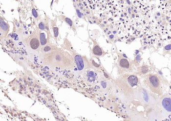 Anillin Rabbit Polyclonal Antibody