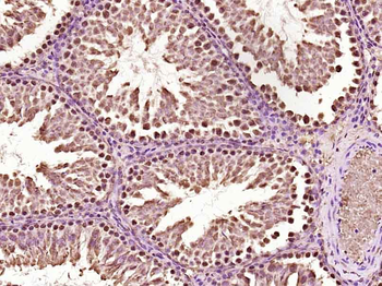 Anillin Rabbit Polyclonal Antibody