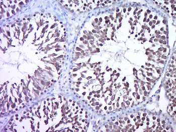 ROR alpha Rabbit Polyclonal Antibody