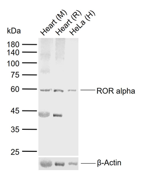 ROR alpha Rabbit Polyclonal Antibody