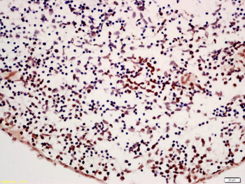 APOBEC3B Rabbit Polyclonal Antibody