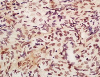 APOBEC3B Rabbit Polyclonal Antibody