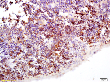 APOBEC3B Rabbit Polyclonal Antibody