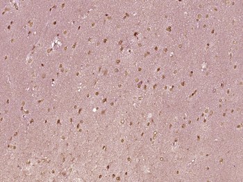 Nucleophosmin Rabbit Polyclonal Antibody