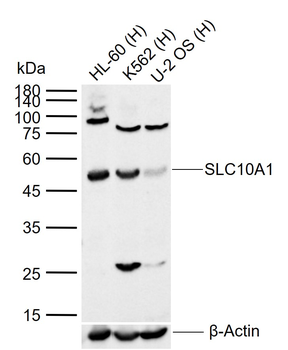 SLC10A1 Rabbit Polyclonal Antibody