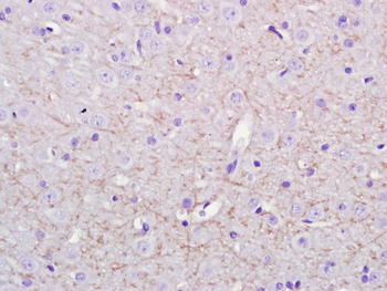 Notch1 Rabbit Polyclonal Antibody