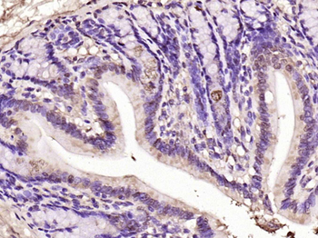 Notch1 Rabbit Polyclonal Antibody