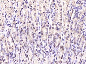 Notch1 Rabbit Polyclonal Antibody