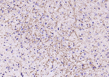 Notch1 Rabbit Polyclonal Antibody