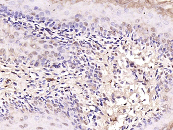 Notch1 Rabbit Polyclonal Antibody