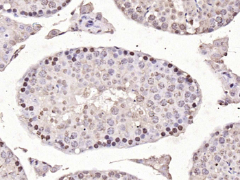Notch1 Rabbit Polyclonal Antibody