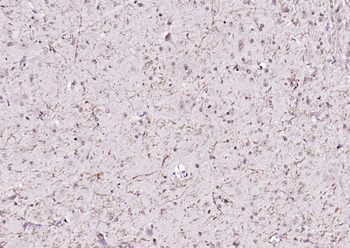 Notch1 Rabbit Polyclonal Antibody