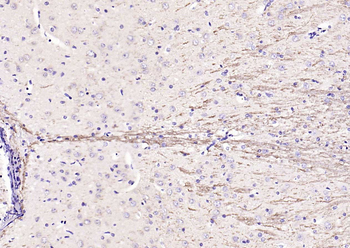 Notch1 Rabbit Polyclonal Antibody