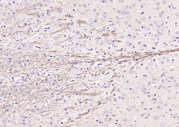 Notch1 Rabbit Polyclonal Antibody