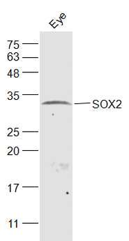 SOX2 Rabbit Polyclonal Antibody