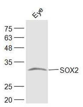 SOX2 Rabbit Polyclonal Antibody