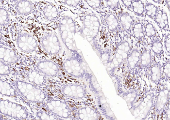CD68 Rabbit Polyclonal Antibody