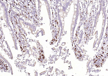 CD68 Rabbit Polyclonal Antibody