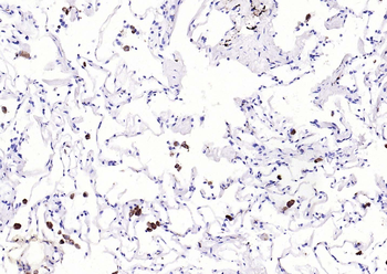 CD68 Rabbit Polyclonal Antibody