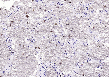 CD68 Rabbit Polyclonal Antibody