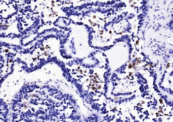 CD68 Rabbit Polyclonal Antibody
