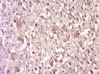 PD-L1 Rabbit Polyclonal Antibody