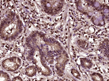 Beta catenin Rabbit Polyclonal Antibody