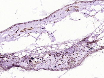 Beta catenin Rabbit Polyclonal Antibody