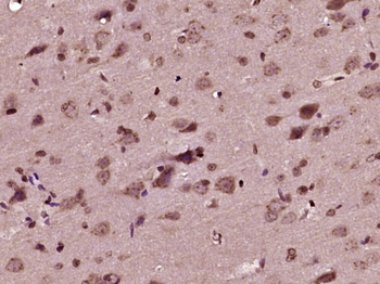 Beta catenin Rabbit Polyclonal Antibody