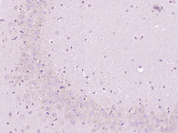 Beta catenin Rabbit Polyclonal Antibody