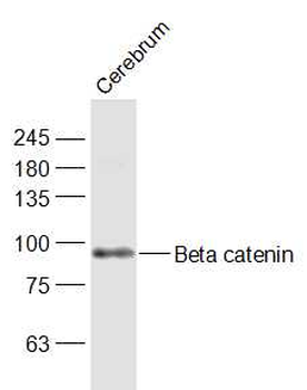Beta catenin Rabbit Polyclonal Antibody