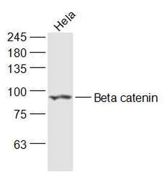 Beta catenin Rabbit Polyclonal Antibody