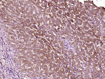Phosphotyrosine Mouse Monoclonal Antibody
