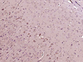 Phosphotyrosine Mouse Monoclonal Antibody