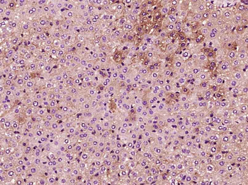 Phosphotyrosine Mouse Monoclonal Antibody