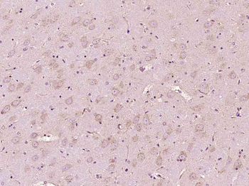 Phosphotyrosine Mouse Monoclonal Antibody